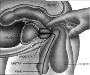 El crecimiento benigno de la próstata es el motivo más frecuente de visita al especialista.